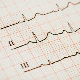 Introduction to Basic EKG Tutorials